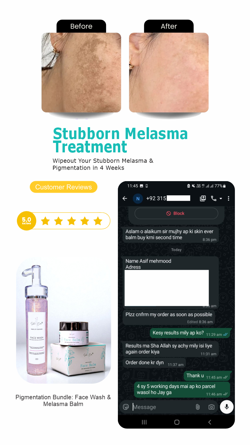 Face Balm For Melasma