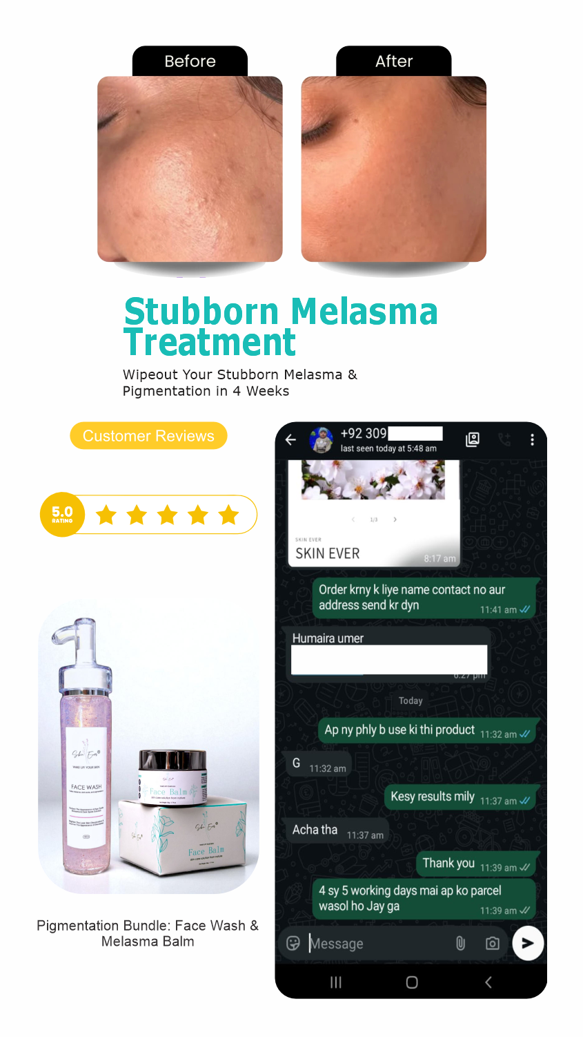 Face Balm For Melasma
