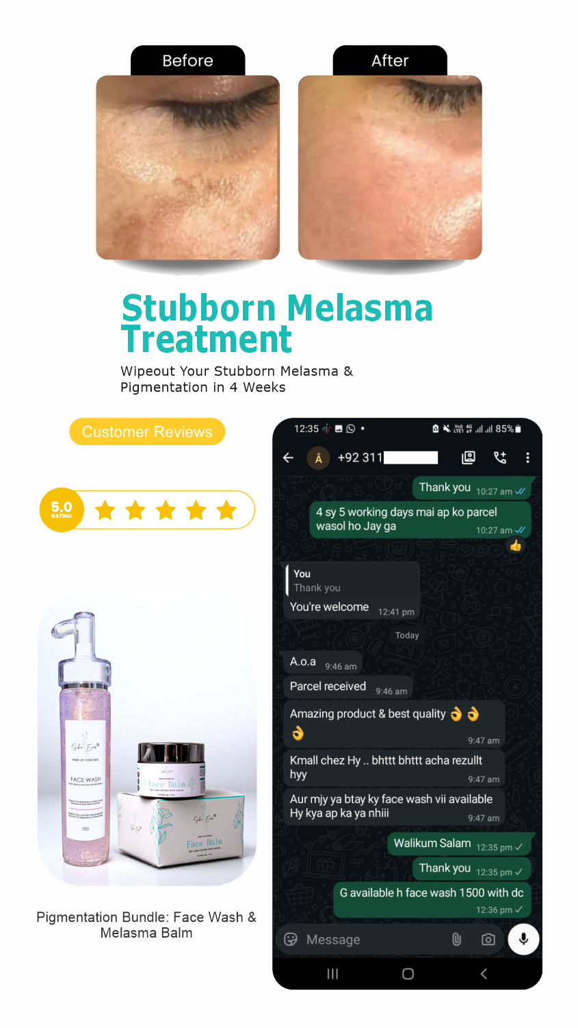 Face Balm For Melasma
